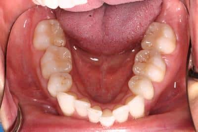 Before Dental Work