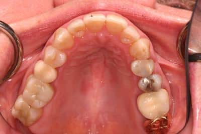 Before Dental Work
