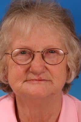 Before Dentures in Grove City
