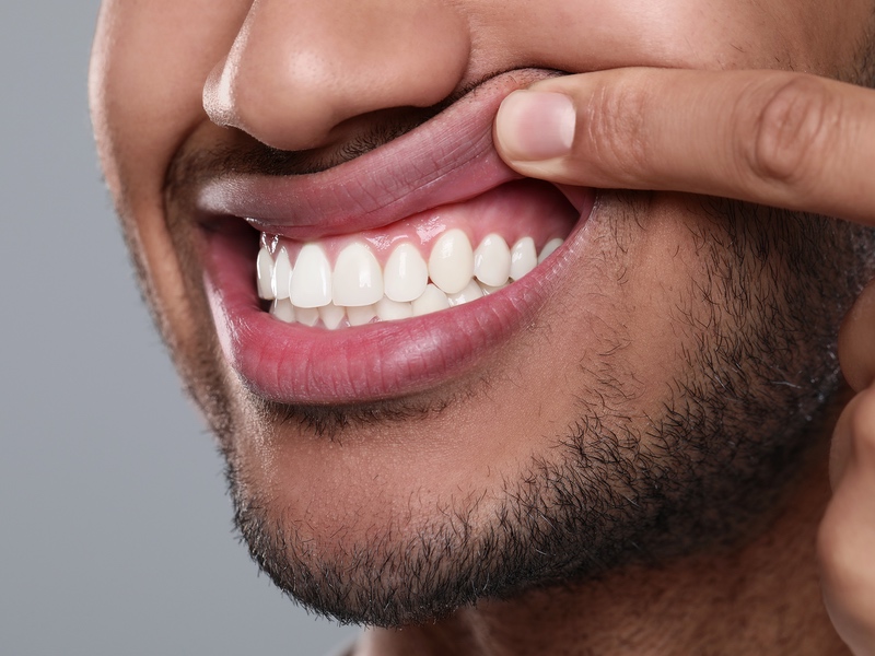 Close-up of a person pulling their upper lip to reveal their teeth.