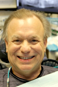 Real patient before Invisalign photo